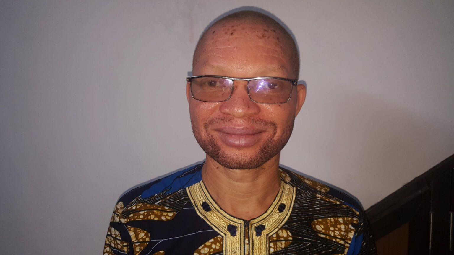 L’ANAT et CBM s’unissent pour le bien être des personnes atteintes d’albinisme